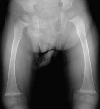 Alagille (4).jpg
